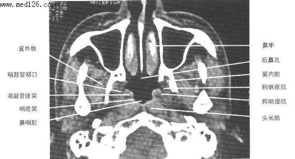 鼻窦的解剖
