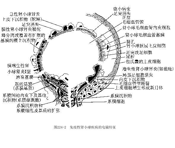 肾脏病理图片