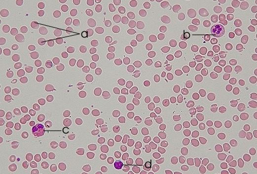 a 红细胞;b 中性粒细胞;c 嗜酸性细胞;d 淋巴细胞