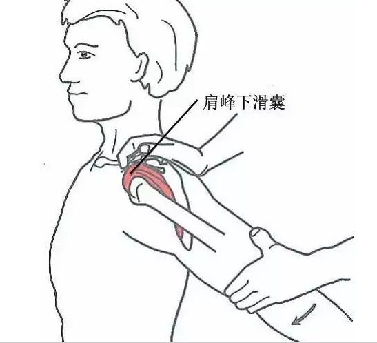 冈上肌肌腱压痛点此压痛点在肱骨大结节的冈上肌止点处,按压时疼痛可