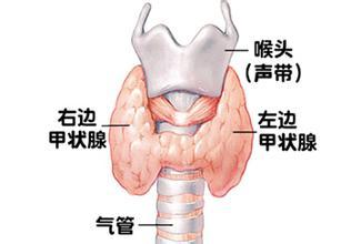 甲状腺脖子图片