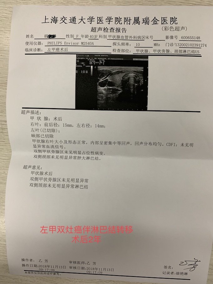 外科医生最欣喜的事主刀完成的甲状腺癌术后复查超声报告二