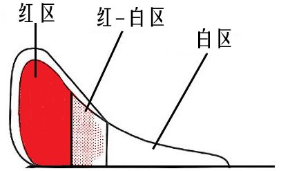 半月板损伤该怎么办?看这篇文章就够了!