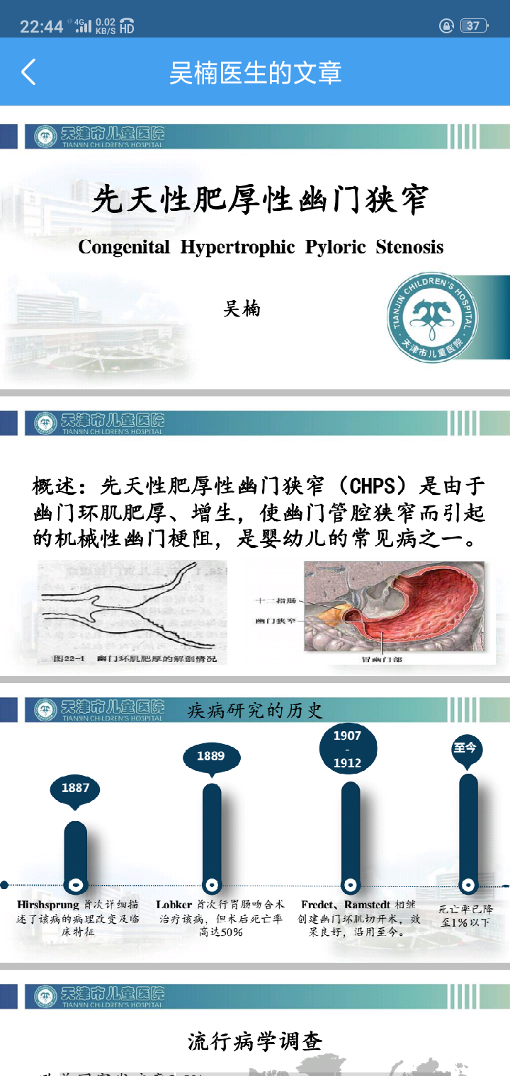 先天性肥厚性幽门梗阻简介