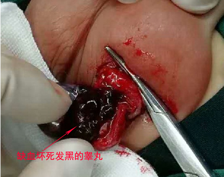 宝妈千万莫大意 近日我科收治了多名因