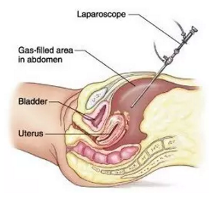 1492397588663428.png 3.png