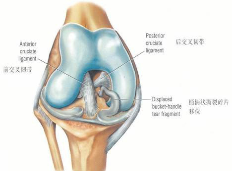 半月板术后康复训练