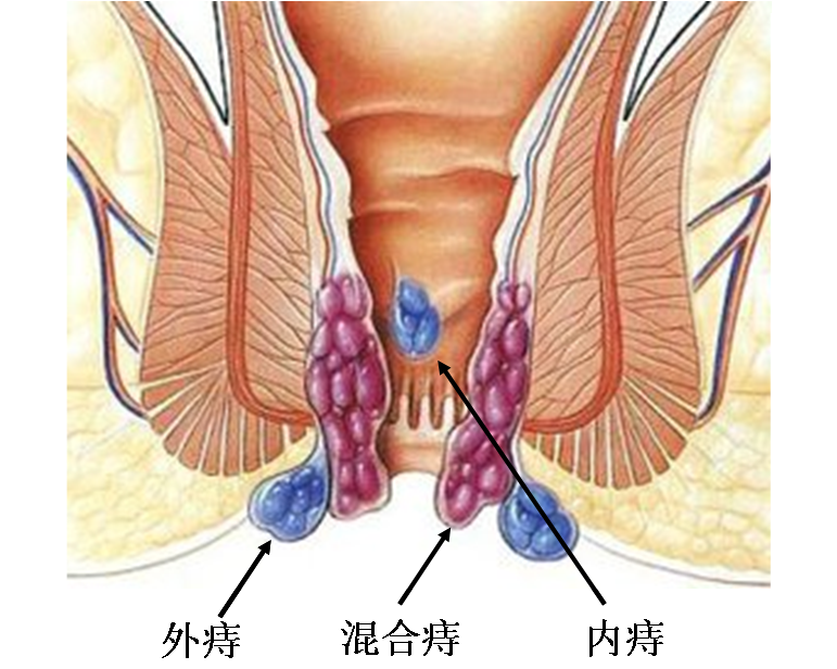 1491123077278997.png 1491123077278997.png