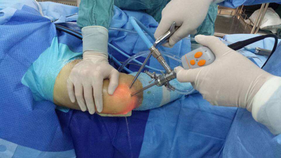 【康复锻炼】膝关节僵硬松解术后锻炼及如何防