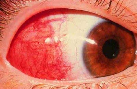 1493078971232795.jpg timg (1).jpg