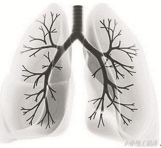 肺纤维化已经很严重,还要合并肺气肿,特点是容