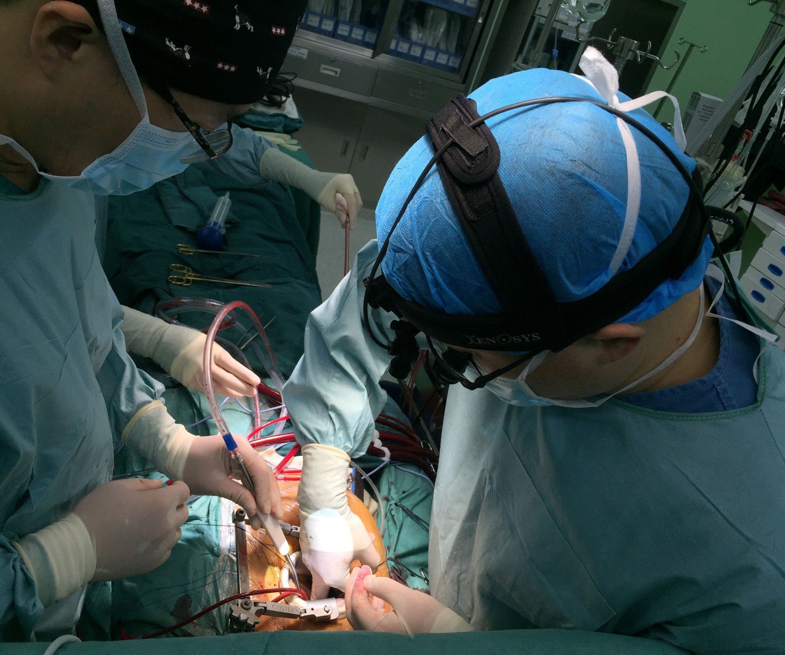 第七节 儿童主动脉瓣替换术-外科学-医学