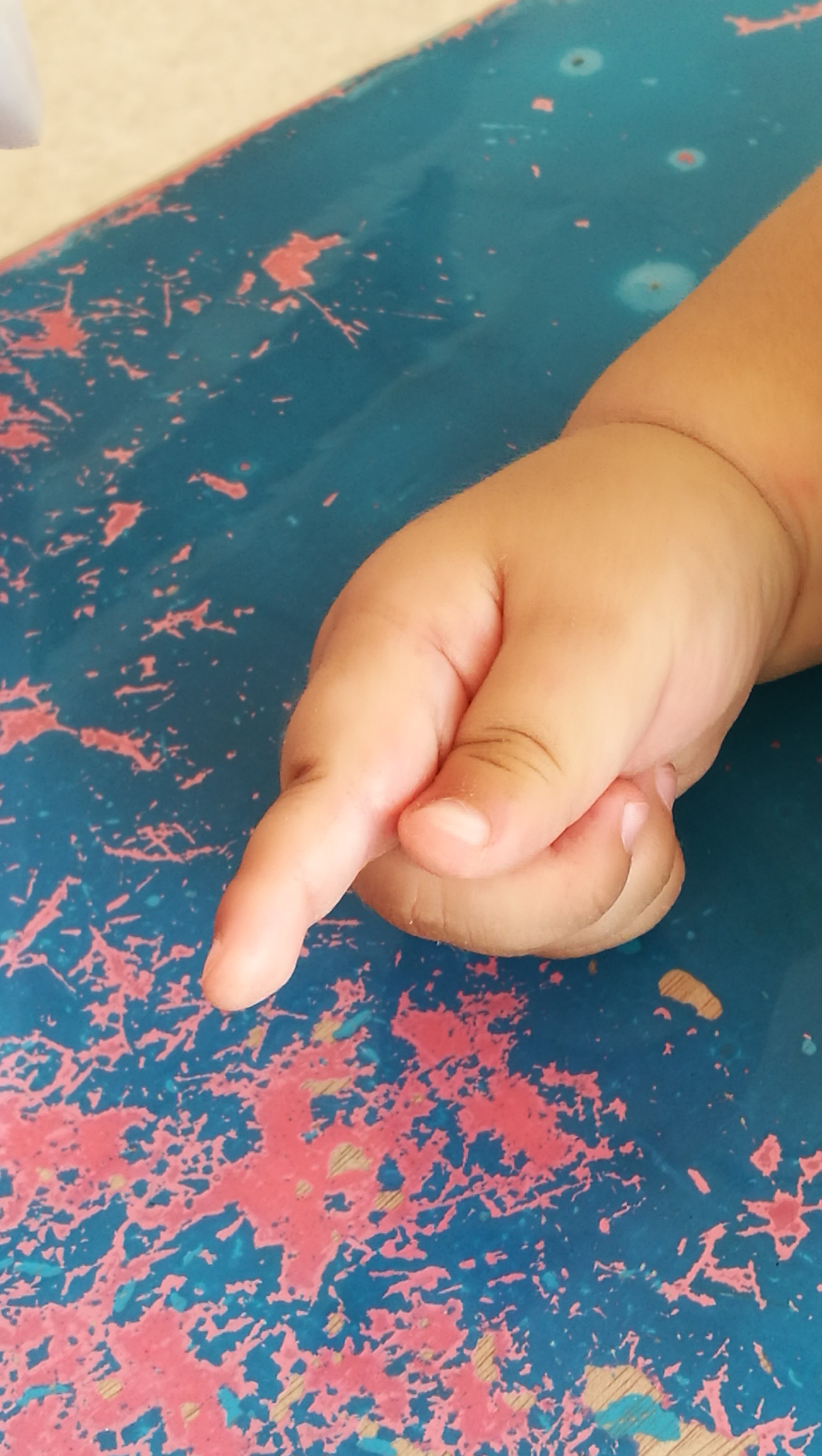 张强 文章列表 痉挛型脑瘫儿童中,手的拇指内收一直是训练的重点和