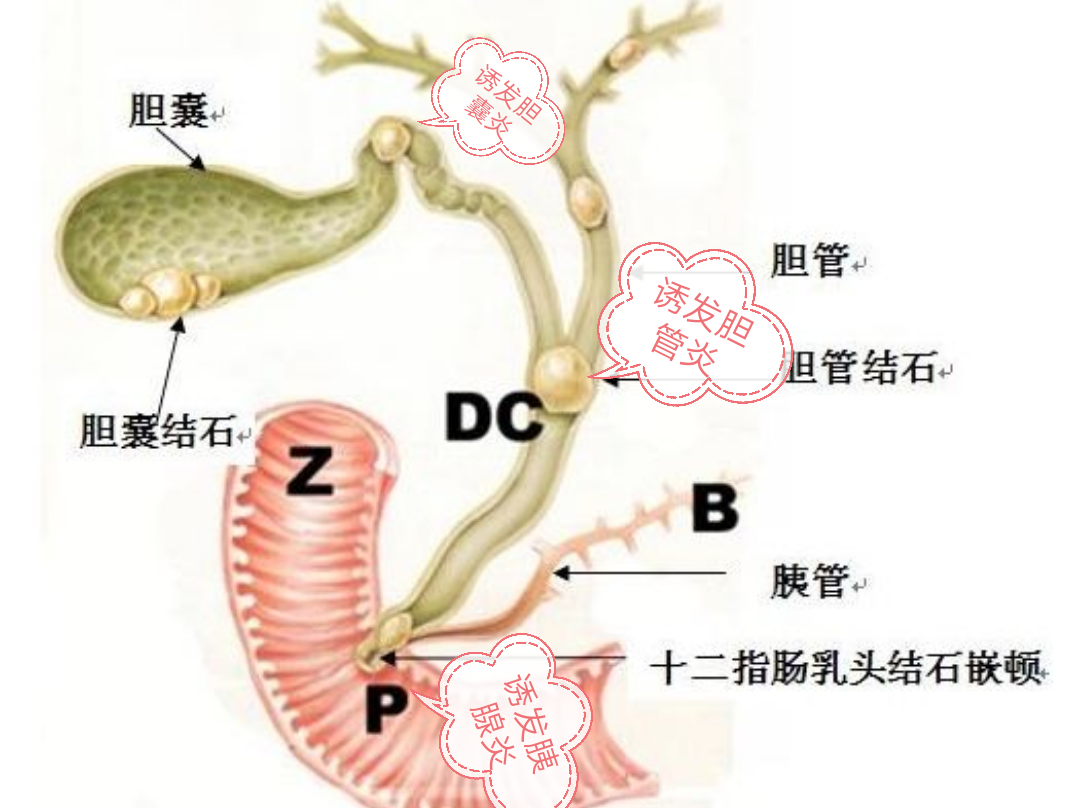 文章列表 >医生,我的胆囊结石必须要做手术吗   上腹部脏器及胆道系统