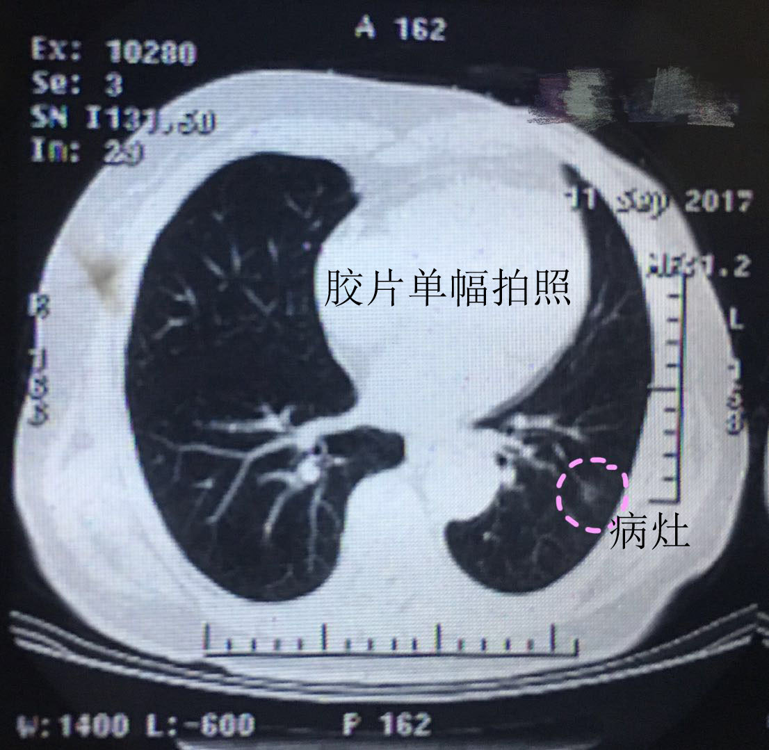 如何向医生提供清晰有效的影像图像——胶片与电子版的差异