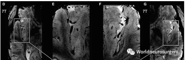 1508069090354862.png blob.png