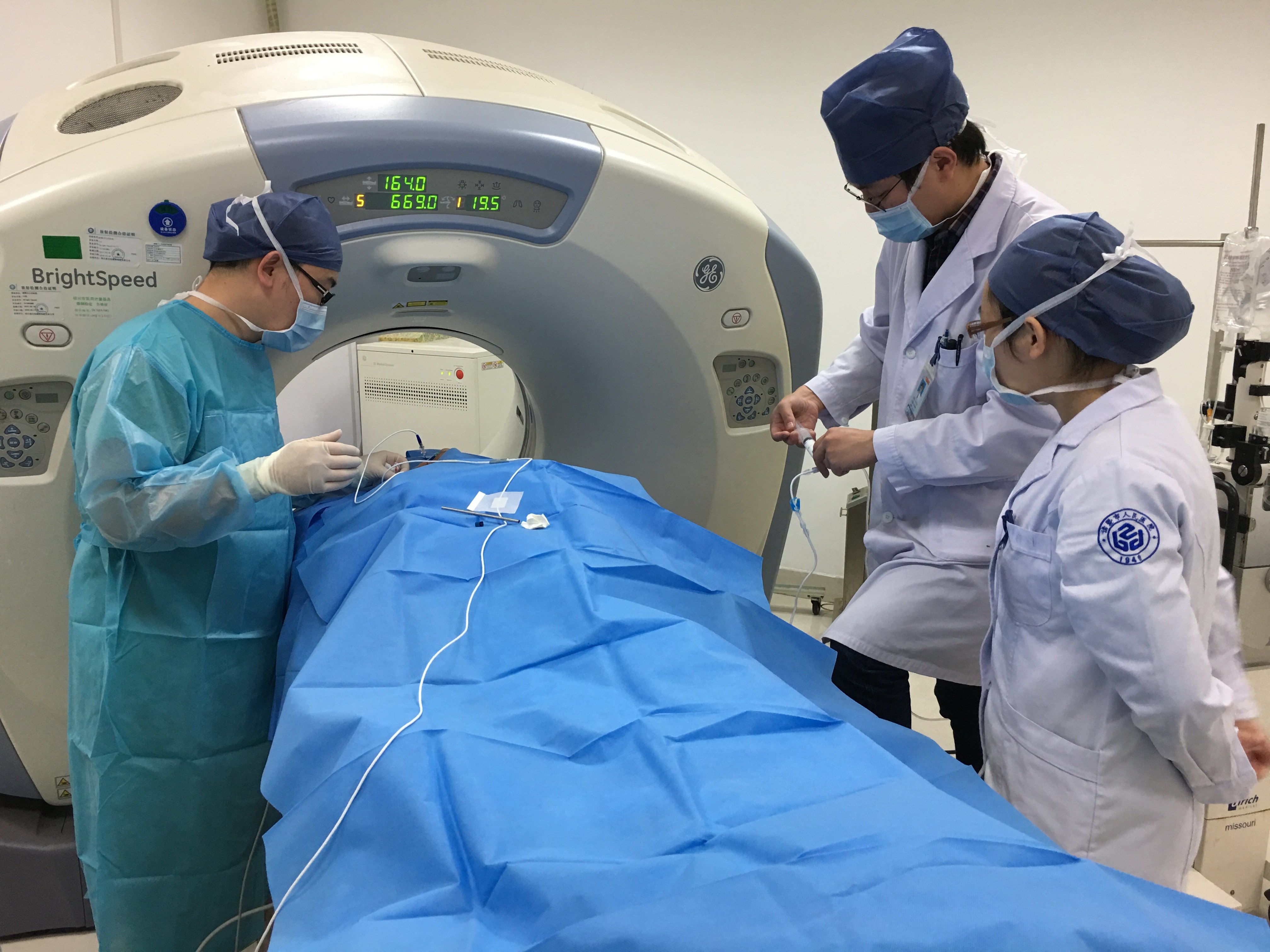 三叉神经痛微创手术治疗