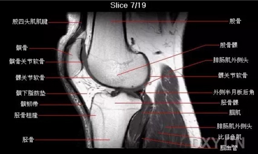 【关节影像】膝关节的磁共振(mri)解剖表现