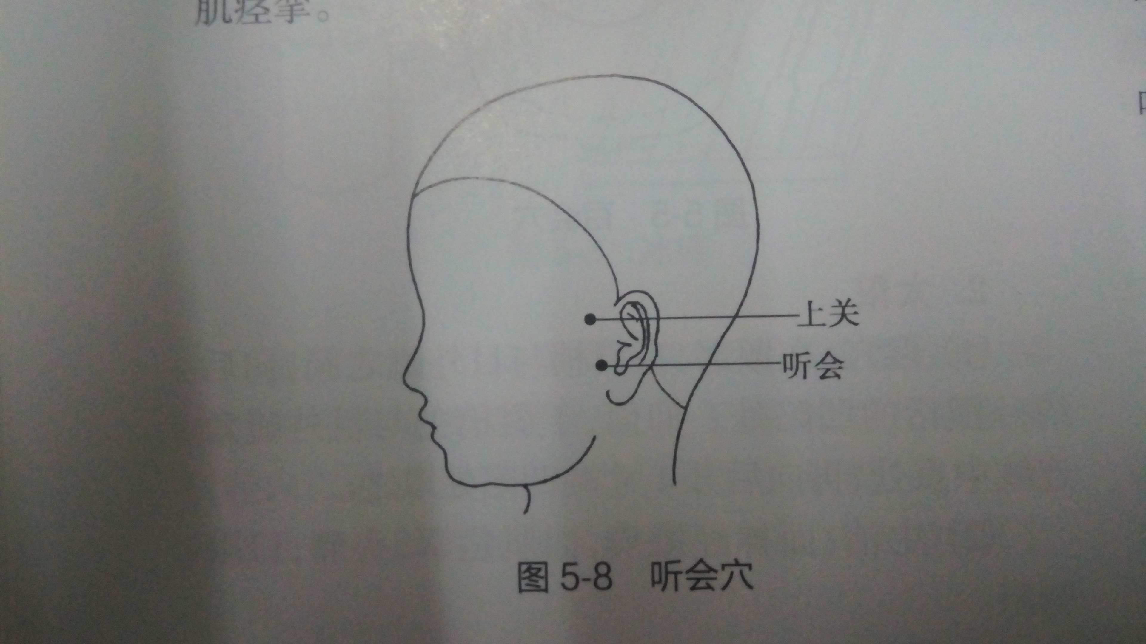 听宫穴 耳屏前,下颌骨髁突后缘,张口呈凹陷处耳门穴 耳廓上切迹的