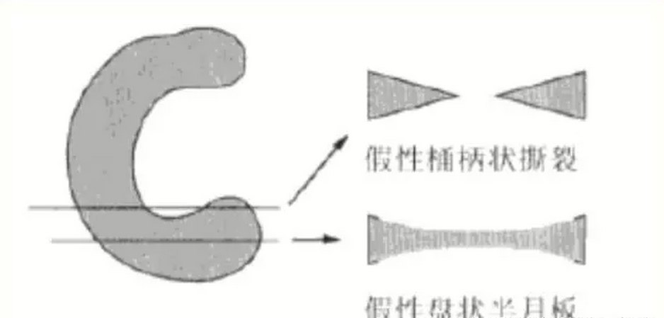 后角部分弧度较大,在冠状面与桶柄状撕裂,盘状半月板相似.