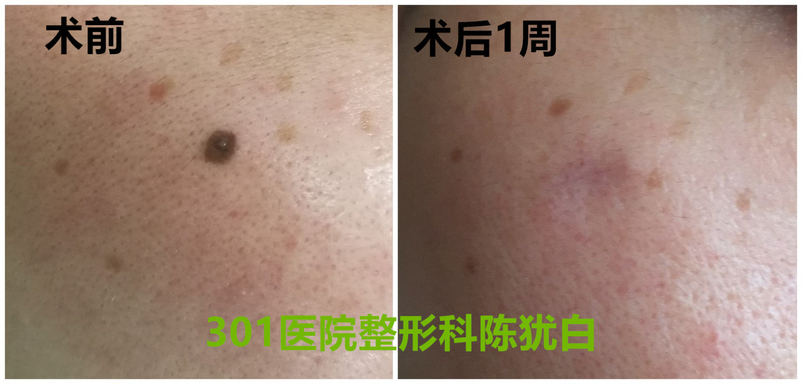 1496415434931945.jpg initpintu_副本.jpg