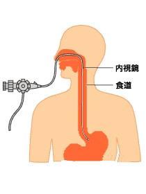 1513495900243266.jpg 1513495900243266.jpg