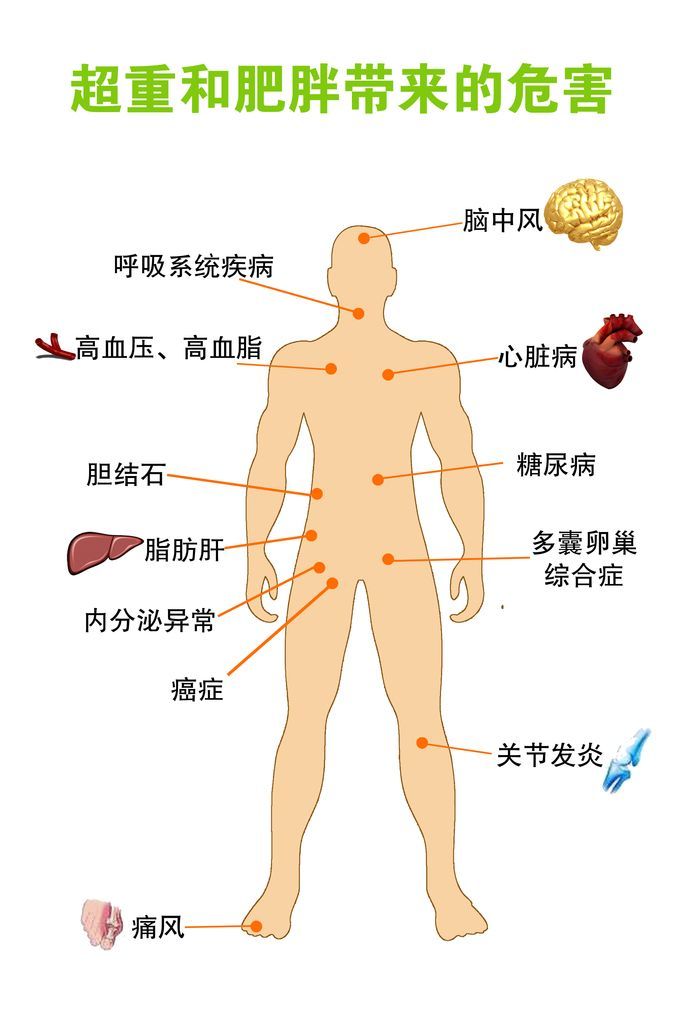 单纯性<!--HAODF:8:feipangzheng-->肥胖<!--HAODF:/8:feipangzheng-->做反复减肥不成功能做减重手术吗