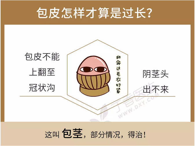 「图说」包皮过长,包茎和包皮环切那些事!