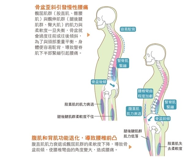 女人产后之"骨盆"