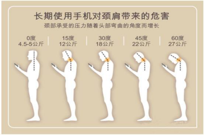 保持正常的颈椎曲度--拥有美丽健康的颈椎