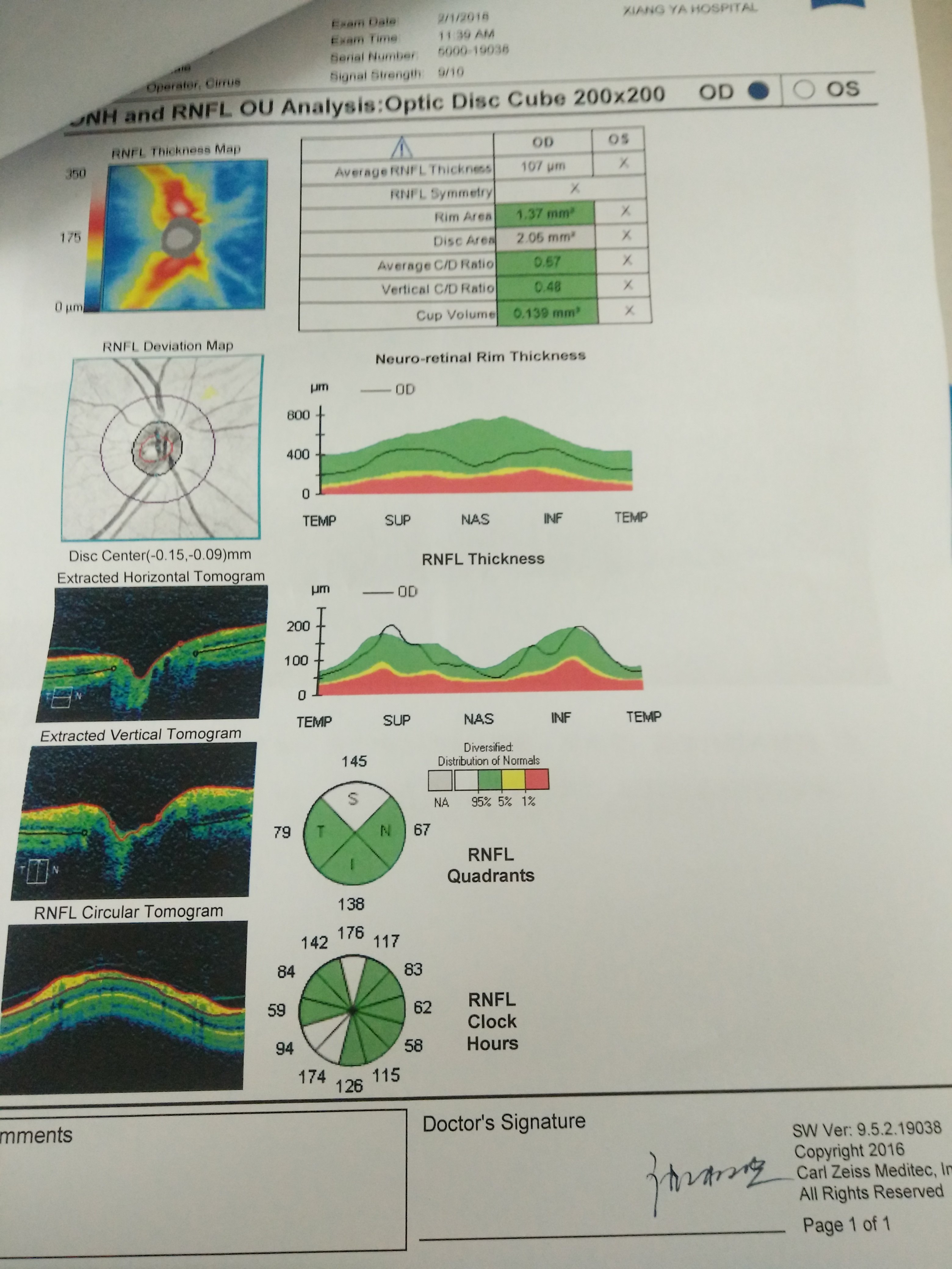 视神经oct的详细图解 青光眼oct的详细图解 伤感说说吧 视神经oct的详细图解 青光眼oct的详细图解 伤感说说吧