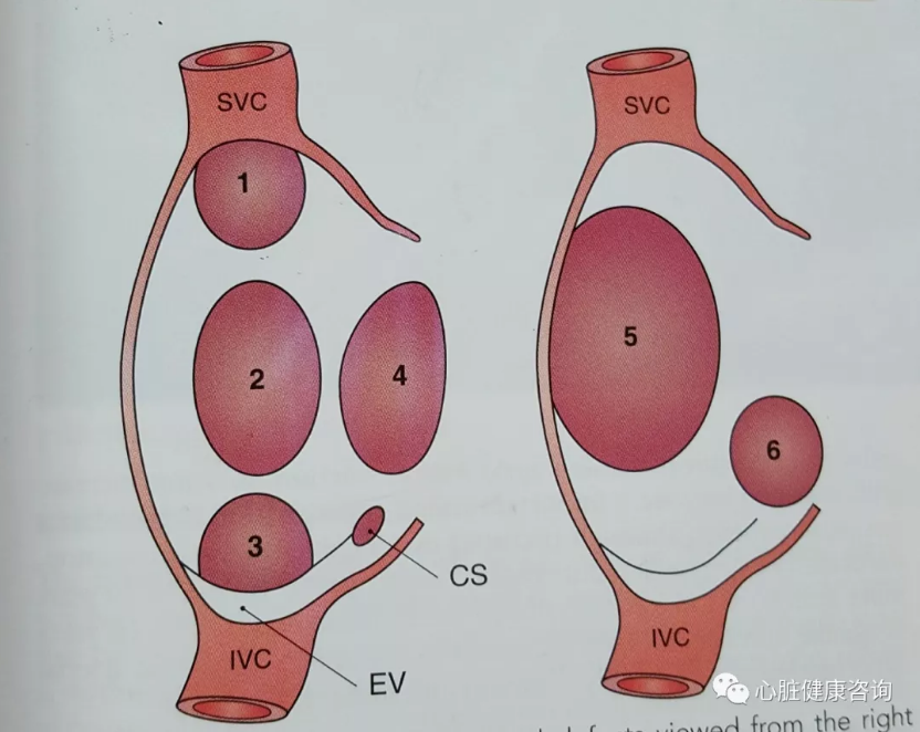 先心病(三)什么样的房间隔缺损需要手术?