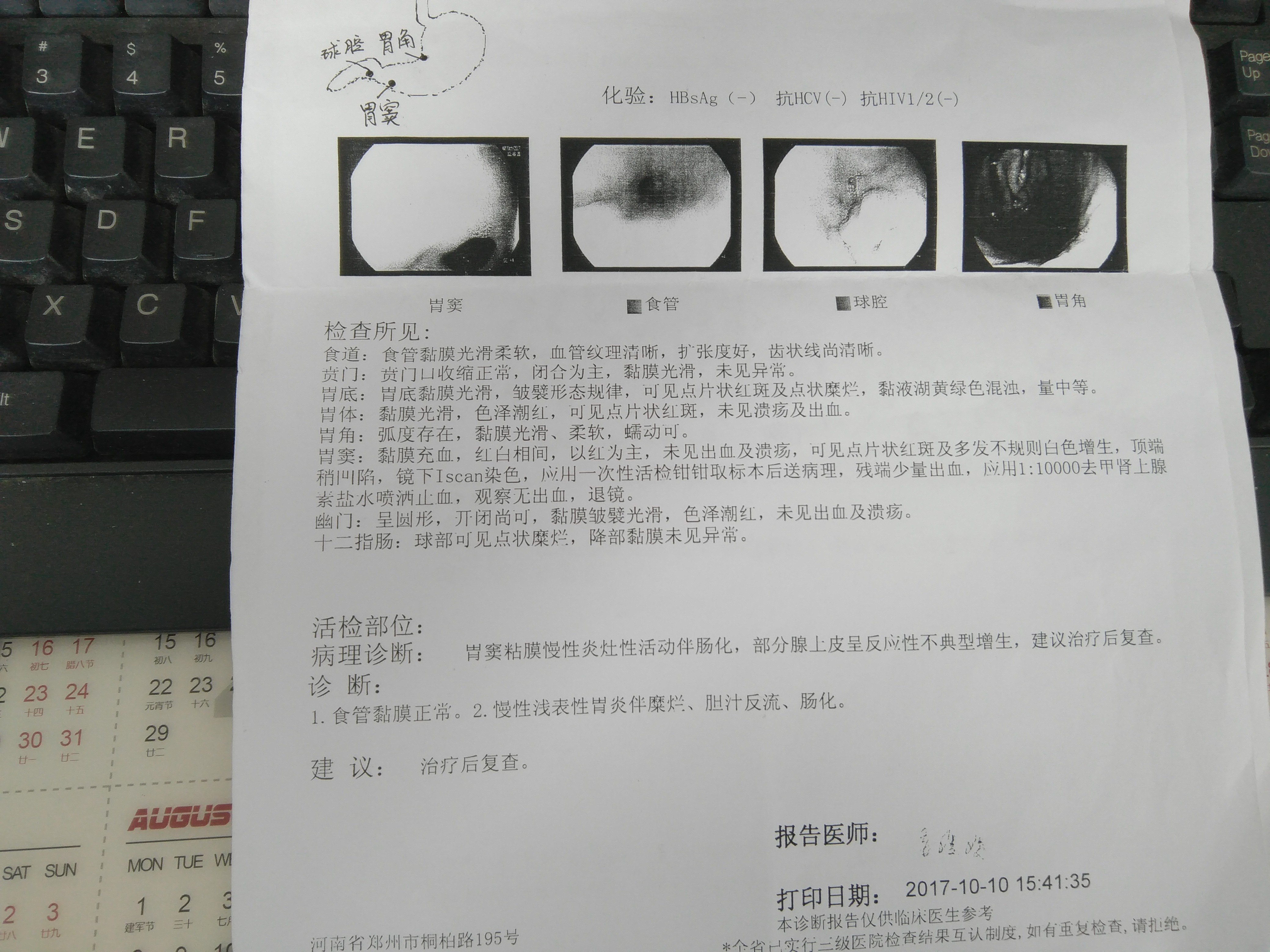 萎缩性胃炎伴肠化,不典型增生临证治验