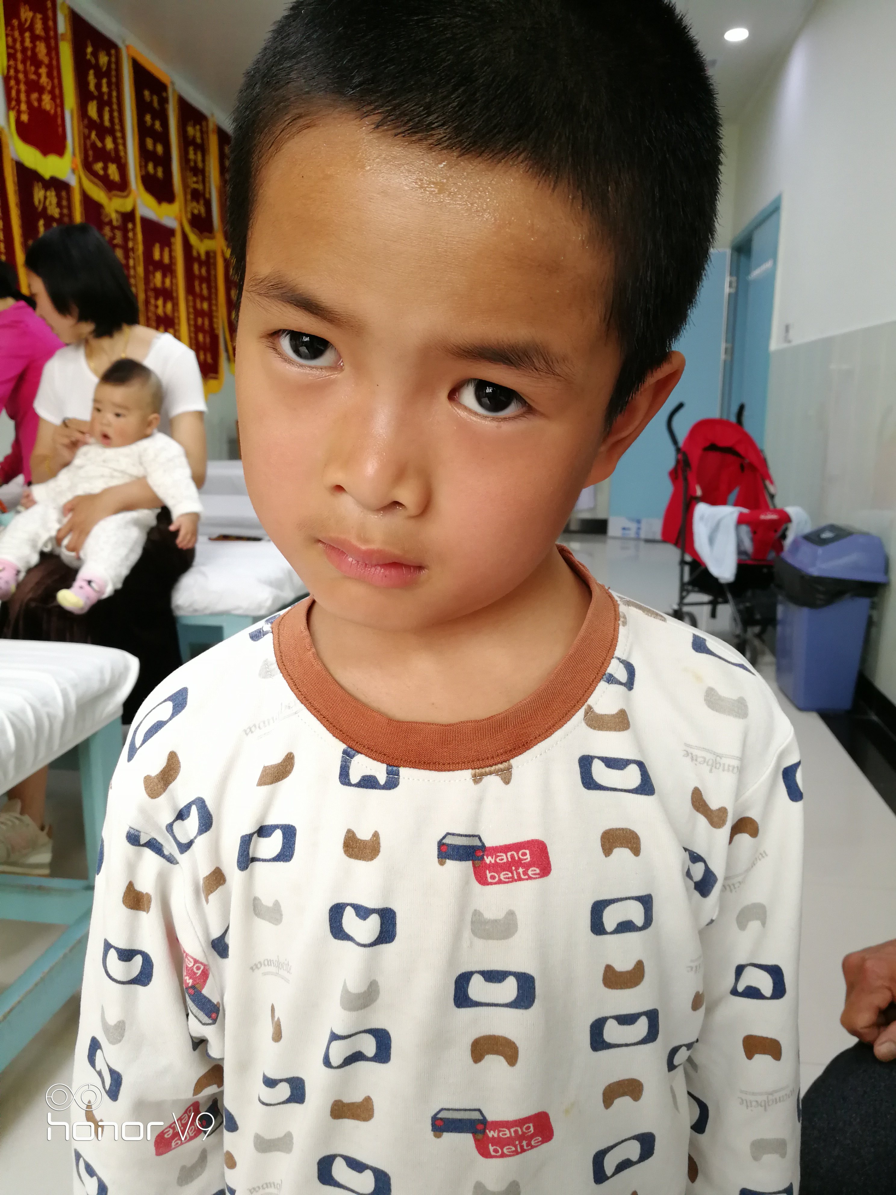 来自一位无包无粗筋斜颈宝宝妈的诊治心得.(最具代表性一).