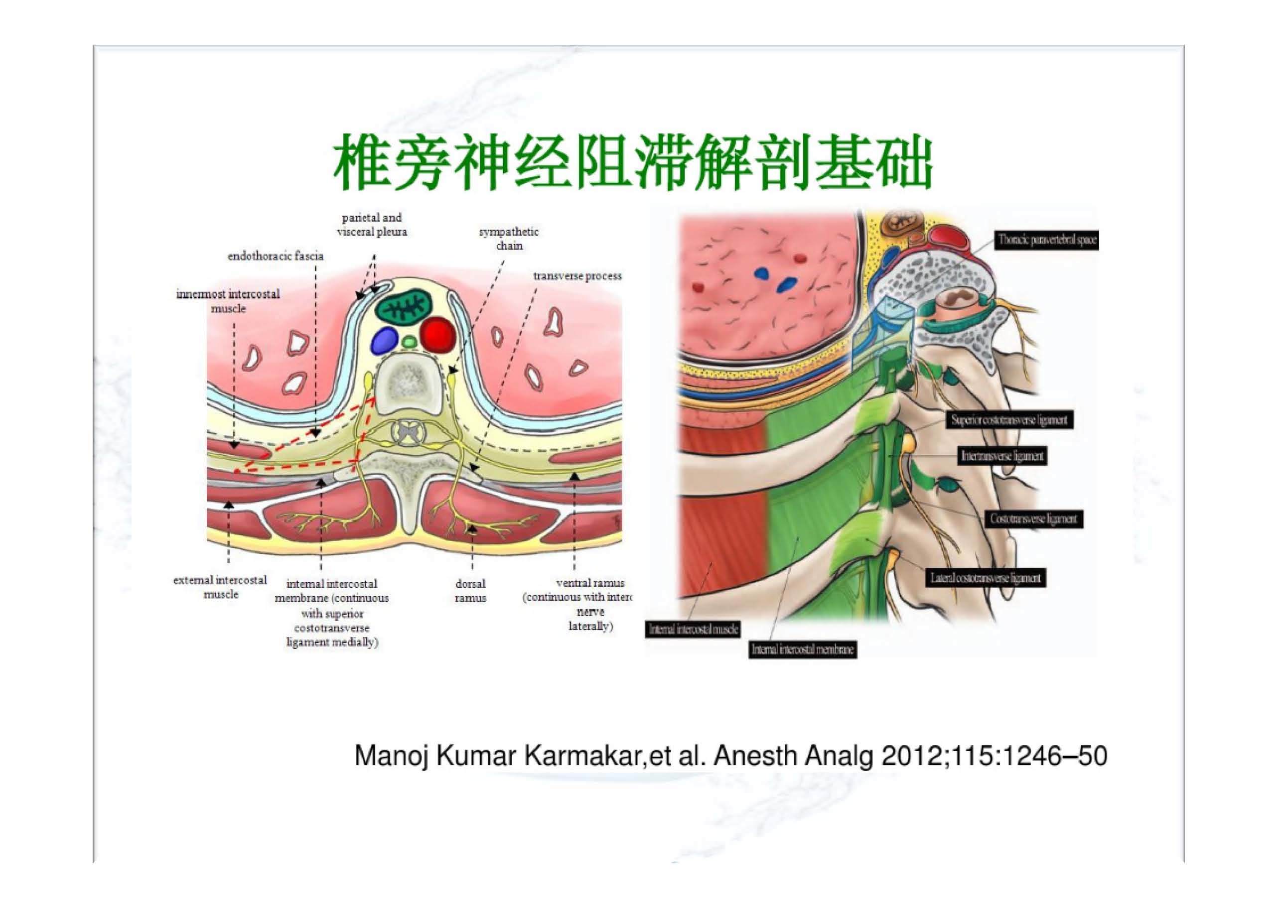 实用胸椎椎旁神经阻滞