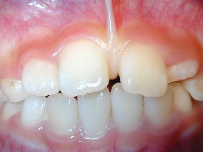 1523460786103191.jpg 7af40ad162d9f2d397cf4a1da2ec8a136227cc62.jpg