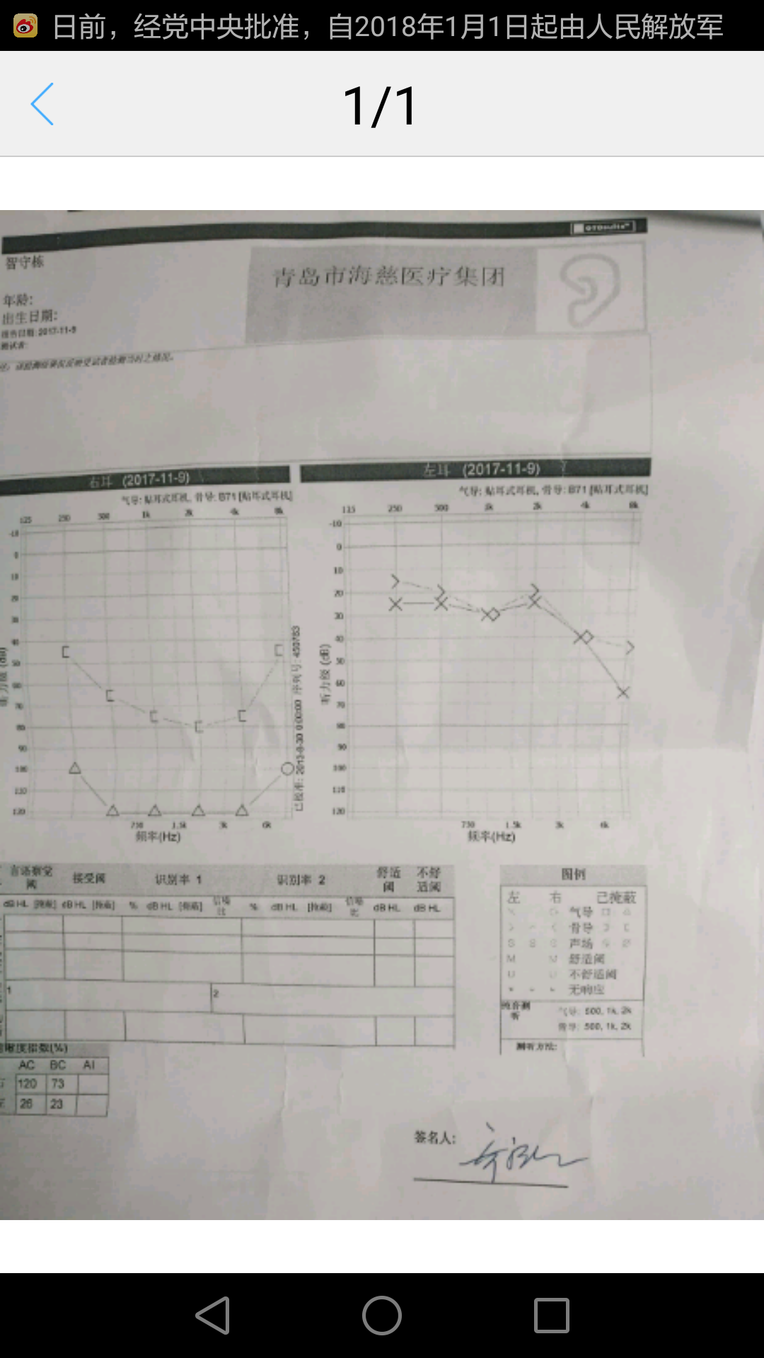 介绍一种安全可靠治疗突发性耳聋的方法(山东青岛)