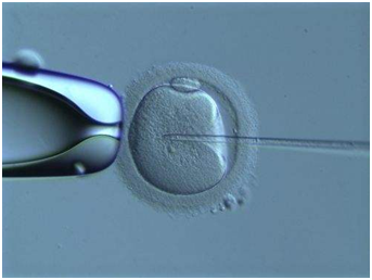 试管婴儿,一代好还是二代好?