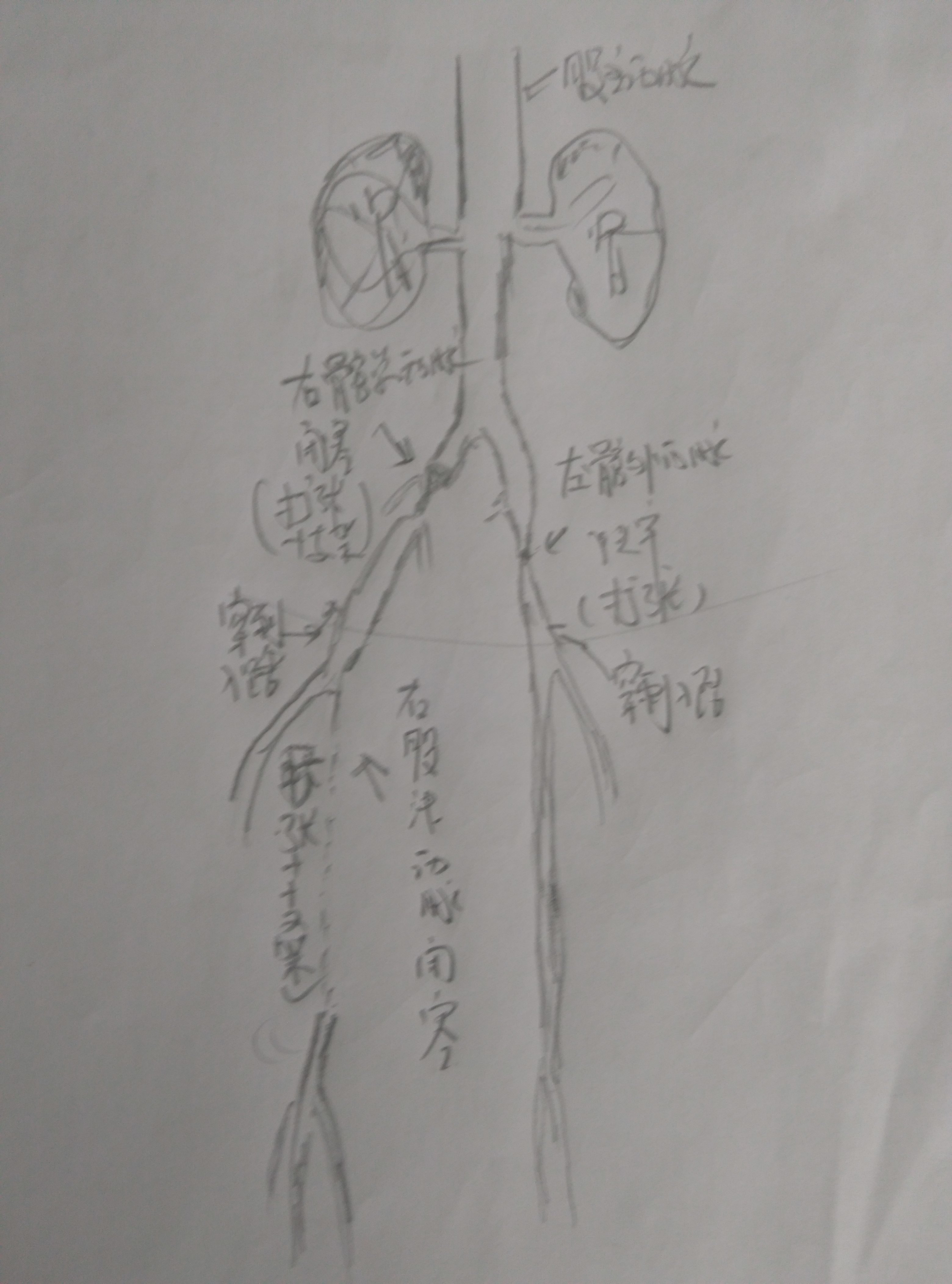 手术示意图及手术计划