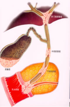 何谓真正的微创十二指肠镜微创治疗胆总管结石应用解剖图