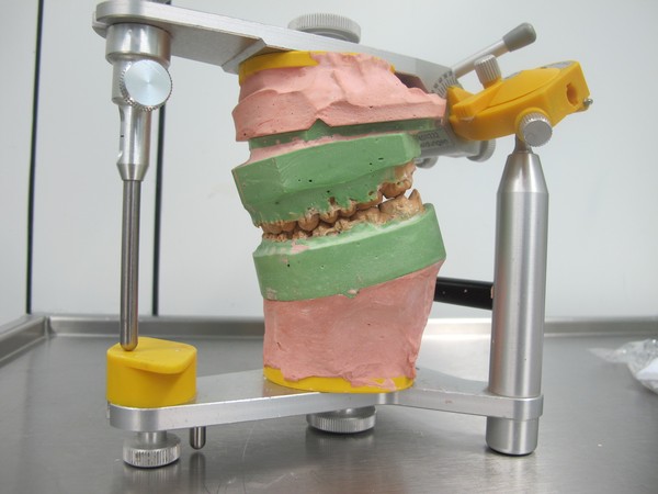 德国归来,思索正颌