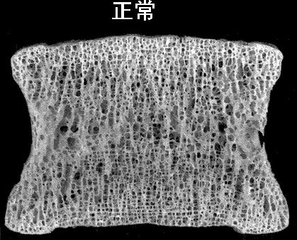 看看正常骨切片