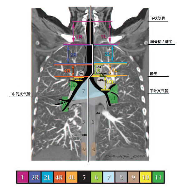 纵隔淋巴结分区图谱美国胸科协会