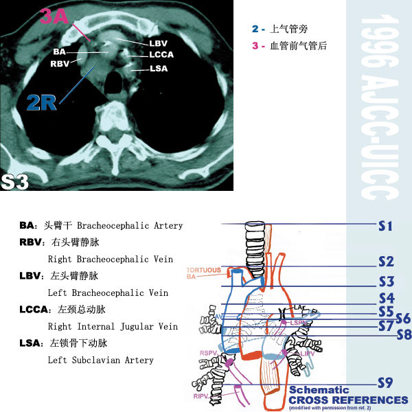 纵膈淋巴结分区图谱(ajcc-uicc)