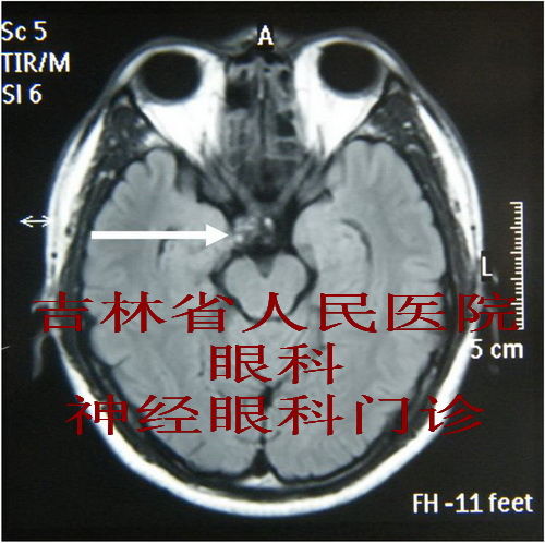 神经外科_神经外科收入