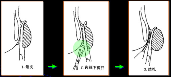 痔疮_痔疮治疗方法 - 好大夫在线