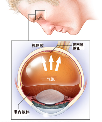 示意图.png