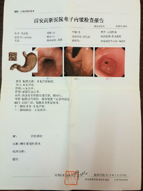 膏方治疗萎缩性胃炎患者的胃镜,病理前后对照(图片)