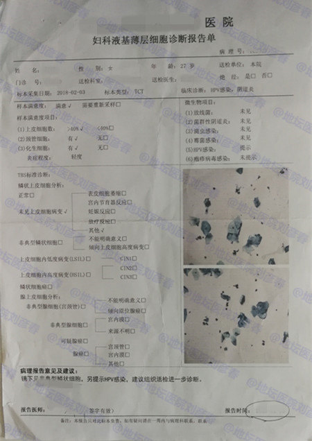 尖锐湿疣是由hpv 感染 导致,例如hpv6,hpv11,hpv16,hpv18,hpv3..