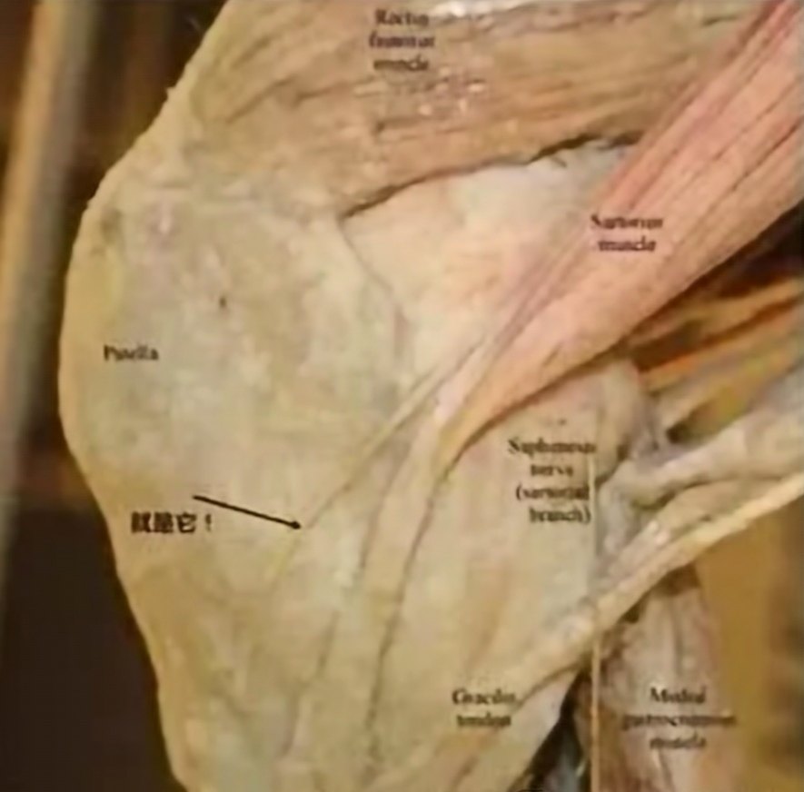 会引起膝关节内侧的疼痛一根神经